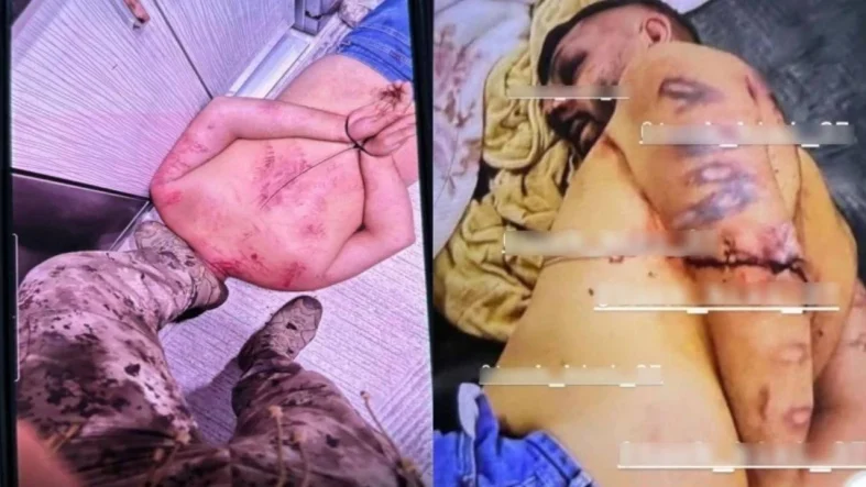 İşkence fotoğrafları kamuoyunla paylaşıldı